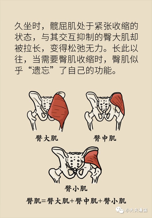 动静健康 | 久坐成伤,臀部遭殃!今天聊一聊死屁股综合