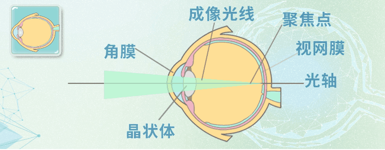 动静健康80的高度近视可能会出现并发症甚至造成失明别再不当回事了