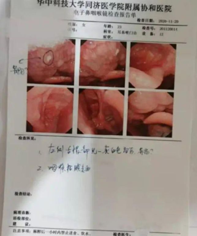 电子喉镜报告单图片