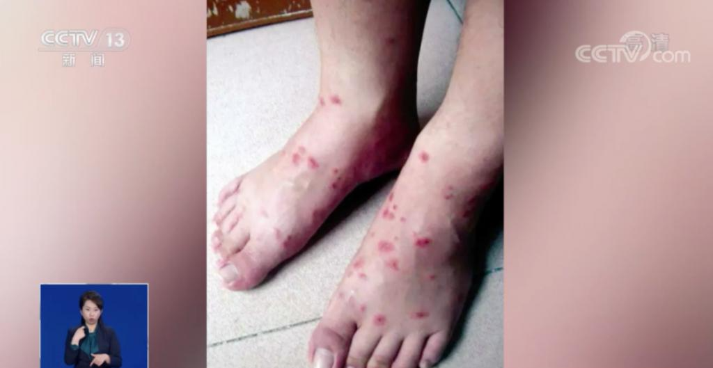 被咬一口或可致命无敌外来物种入侵仁怀曾出现过