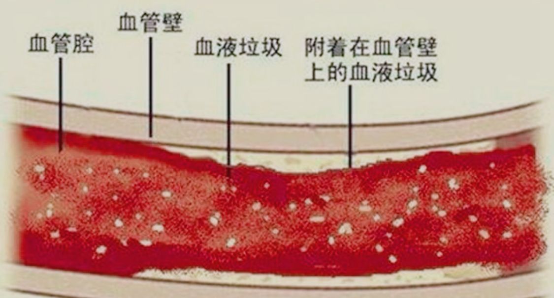 同在蓝天下什么是血液粘稠如何缓解